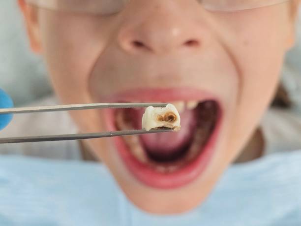 Best Walk-In Emergency Dentist in French Island, WI